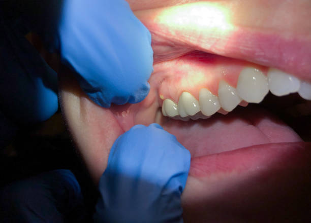 Best Cracked Tooth Emergency Dentist  in Rice Lake, WI