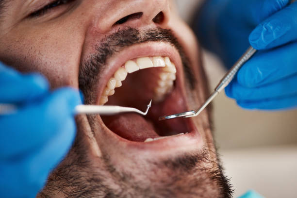 Best Teeth Whitening  in Rice Lake, WI