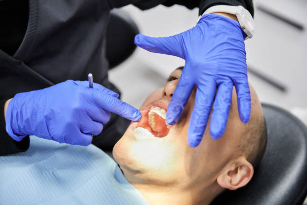 Best Knocked-Out Tooth Emergency  in Rice Lake, WI