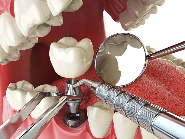 Best Tooth Pain Emergency Relief  in Rice Lake, WI