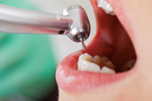 Best Emergency Dental Filling Replacement  in Rice Lake, WI